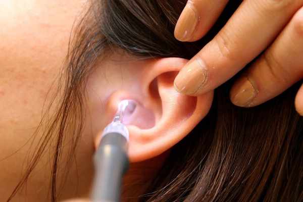 Ways to Remove Earwax