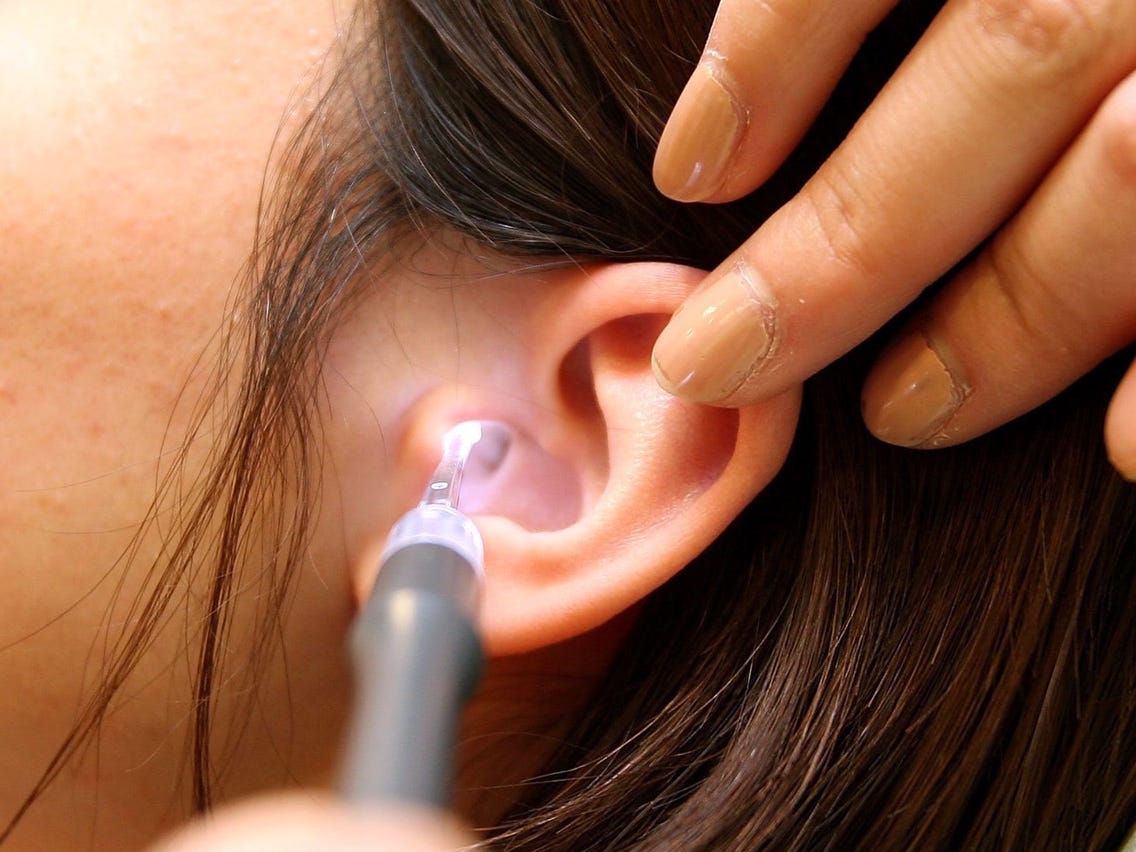 Ways to Remove Earwax