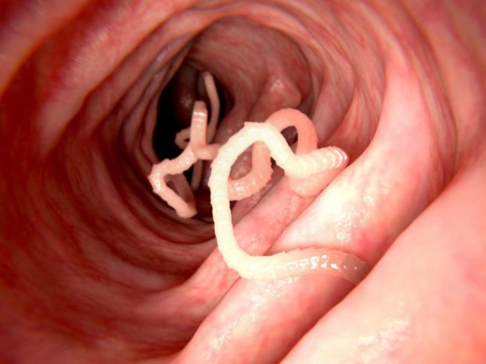 Tapeworms in Humans