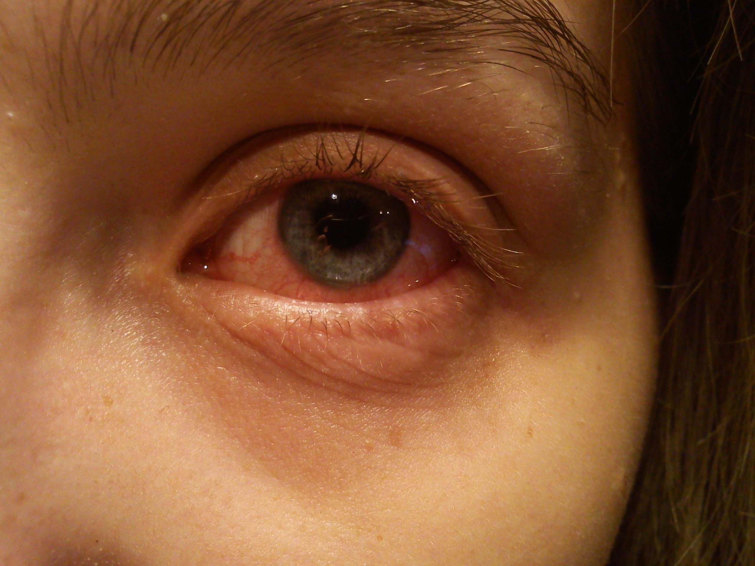 Find out how long is pink eye contagious benchmark monitor